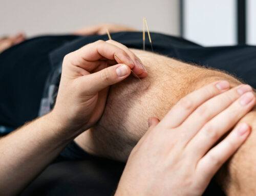 Acupuncture for Injury Prevention in Athletes