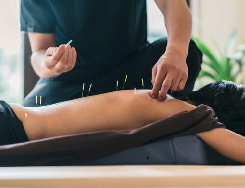 Speed Up Recovery with Sports Acupuncture